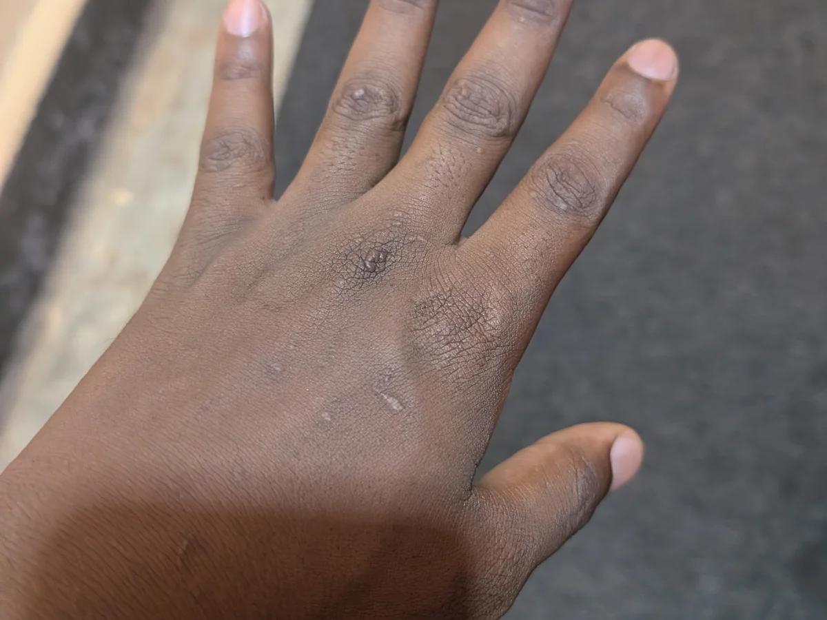 Hand